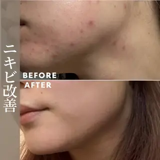 肌育成サロン ♡ RISAのエステ・リラクイメージ