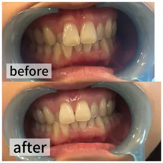 浮腫|肩こり|張り 日々の疲れを解消★のエステ・リラクイメージ