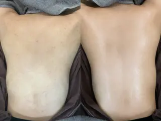 艶肌デトックス🫧 Samiraのエステ・リラクイメージ