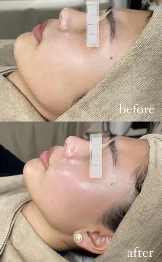 エステサロン Mi-mi.iのエステ・リラクイメージ