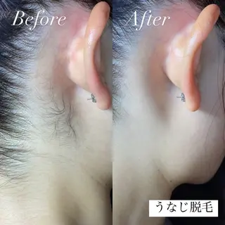 emiluca西目/ 脱毛/細胞美容のエステ・リラクイメージ