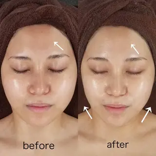 𝐌𝐚𝐜𝐡𝐞 𝐛𝐲 𝐌𝐚𝐲𝐮所属・ハーブピーリング🌿 𝑴𝒂𝒚𝒖のエステ・リラクイメージ