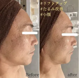 メンズ Dahlia痩身脱毛 フェイシャル 中村のエステ・リラクイメージ