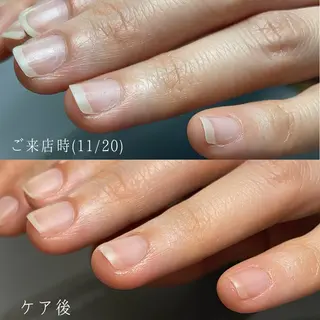 ネイル Aim* 深爪自爪育成専門店のネイルデザイン