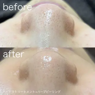 lulularico Yuのエステ・リラクイメージ