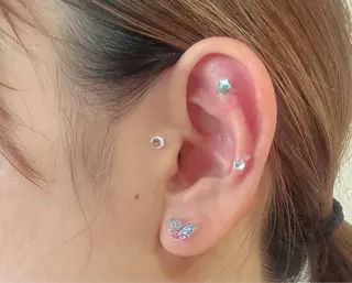 脱毛・ホワイトニング 耳ツボ・美白・毛穴のその他イメージ