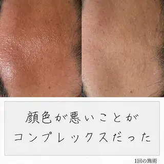 ニキビ経験者が施術 する専門サロン🌻のエステ・リラクイメージ