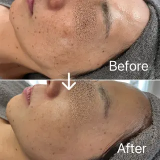 Blue Moon 【ブルームーン】のエステ・リラクイメージ