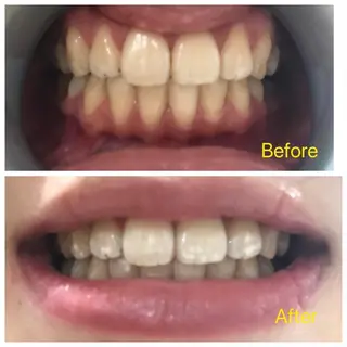 Ｍ渋谷 ホワイトニングのエステ・リラクイメージ