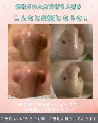 パラ・ ディのエステ・リラクイメージ