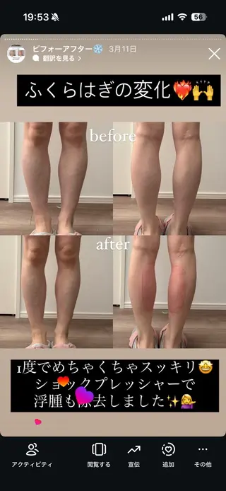 Miiju.所属・石巻 冷却痩身 Miiju. 鈴木のエステ・リラクイメージ