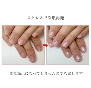 ネイル ネイルサロン アリュームのネイルデザイン