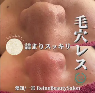 毛穴/シミ肝斑/脱毛 横山梨里のエステ・リラクイメージ