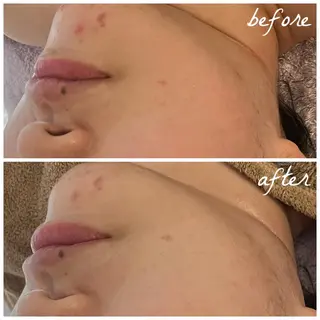 メンズ メナード岐阜茜部 杉浦のエステ・リラクイメージ