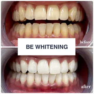 メンズ ホワイトニング専門店 ビーホワイト金山のその他イメージ