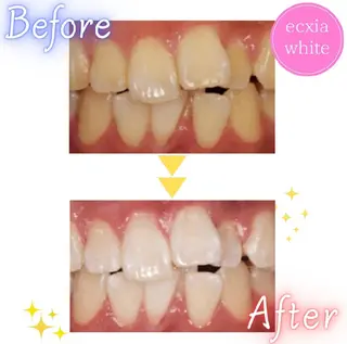 メンズ nanami -ホワイトニングのその他イメージ