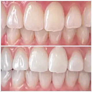 DIAMOND BEAUYのその他イメージ