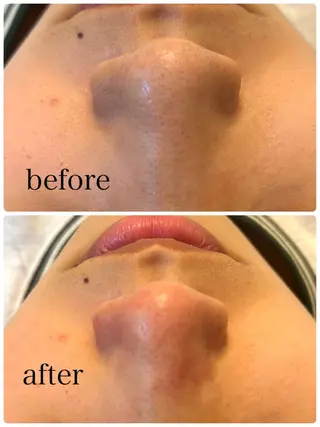 Lash Lift WAVE🩵の眉毛・アイブロウイメージ