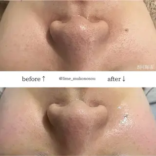 LIME武庫之荘所属・LIME 武庫之荘店のエステ・リラクイメージ