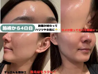 VIKI BEAUTY  クレイハーブピーリング・美肌脱毛専門店所属・VIKI BEAUTYのエステ・リラクイメージ