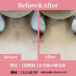 メンズ キッズ 有人型セルフサロン 脱毛／痩身／美顔のエステ・リラクイメージ