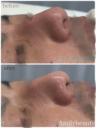 Amily beauty 毛利のエステ・リラクイメージ