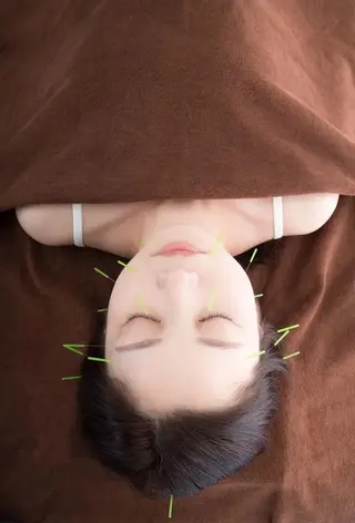 美容鍼灸/小顔鍼灸 肌質改善エステのエステ・リラクイメージ