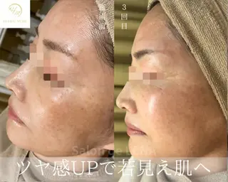 ハーブピーリング専門 グランディール　武内のエステ・リラクイメージ