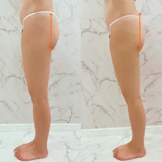 バストアップに特化 した最新機器使用！のエステ・リラクイメージ