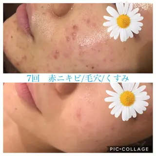 ロング カラー パーマ ヘアアレンジ キッズ ネイル マツエク・マツパ EnsorClair 代表 野口真央のエステ・リラクイメージ