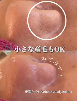 毛穴/シミ肝斑/脱毛 横山梨里のエステ・リラクイメージ