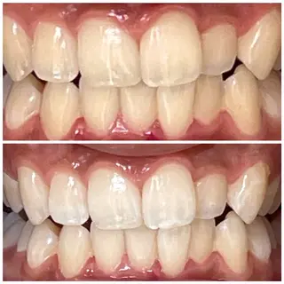 DIAMOND BEAUYのその他イメージ