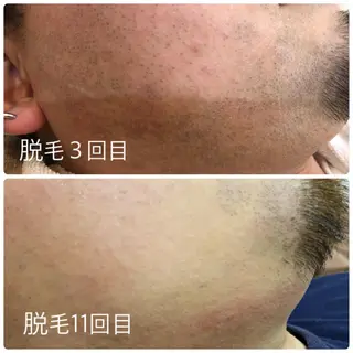 メンズ 人気🌻《髪質改善》 平井 綾乃のヘアスタイル