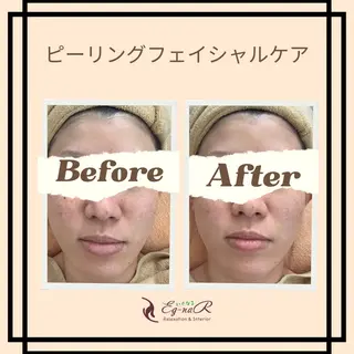 いぐなる 清水のエステ・リラクイメージ