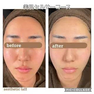 美肌作りのサロン 山村亜美のエステ・リラクイメージ