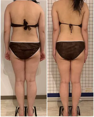 リンパマッサージ&ピラティスmimoza所属・リンパマッサージ mimozaのエステ・リラクイメージ