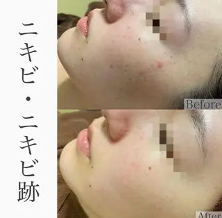 ハーブピーリング専門 BIOPLUS+川崎のエステ・リラクイメージ