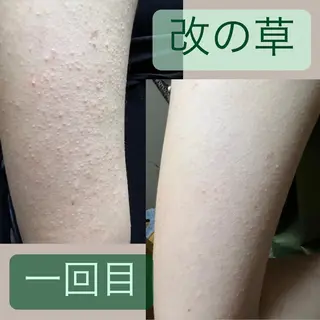 lymph care 'Welnəsのエステ・リラクイメージ