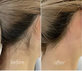 ナチュピ所属・シュガーリングサロン ナチュピのエステ・リラクイメージ