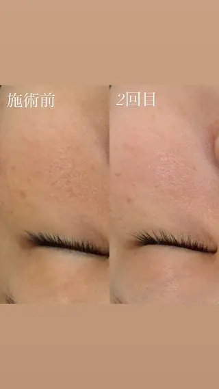 艶肌デトックス🫧 Samiraのエステ・リラクイメージ