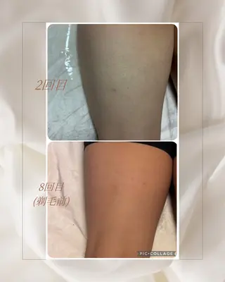 B. salonのエステ・リラクイメージ