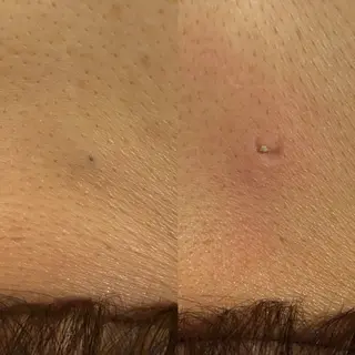 夕希 毛穴と脱毛特化サロンのエステ・リラクイメージ