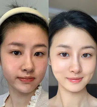 マツエク・マツパ aliaハイフ&水光ジェットサロン所属・aliaハーブ水光店 エステティシャン募集のエステ・リラクイメージ