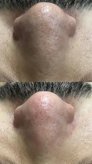 Lilyboo 星のエステ・リラクイメージ