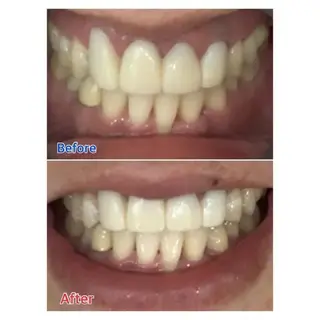 M渋谷 ホワイトニングのエステ・リラクイメージ