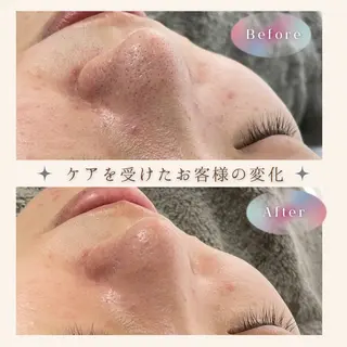 LBSホワイトニング 🌐岡山店のその他イメージ