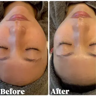 アロマ•ピーリング SalonYokoのその他イメージ