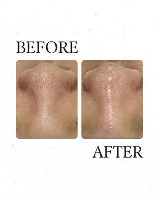 AY'S所属・倉敷/玉島/20代 からの大人毛穴洗浄のエステ・リラクイメージ