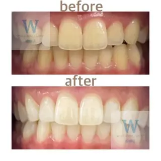 ホワイトニング ショップ船橋店🦷のエステ・リラクイメージ