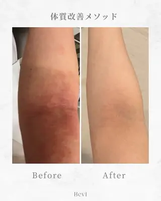 Bevi salonのその他イメージ